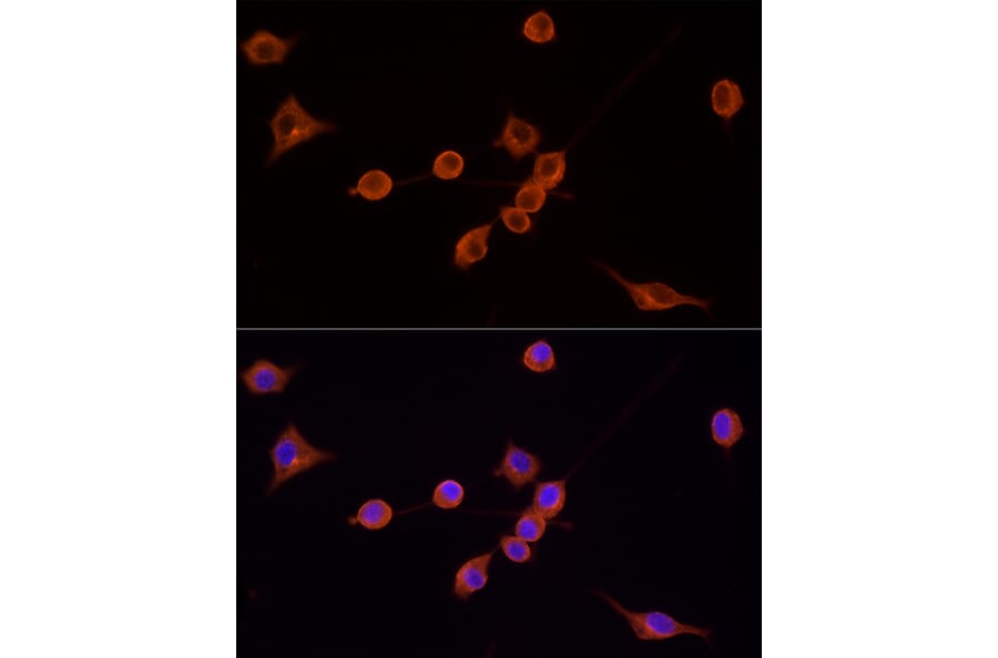 Immunofluorescence - Goat Anti-Mouse IgG H&L Antibody (TRITC) (A17332) - Antibodies.com
