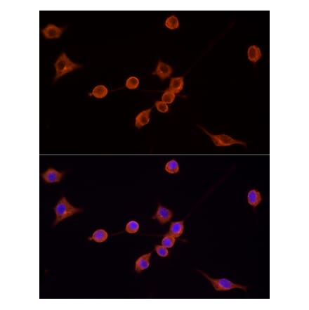 Immunofluorescence - Goat Anti-Mouse IgG H&L Antibody (TRITC) (A17332) - Antibodies.com
