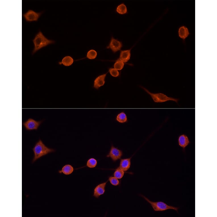 Immunofluorescence - Goat Anti-Mouse IgG H&L Antibody (TRITC) (A17332) - Antibodies.com