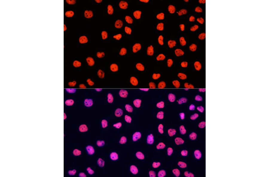 Immunofluorescence - Goat Anti-Rabbit IgG H&L Antibody (Cyanine 3) (A17341) - Antibodies.com