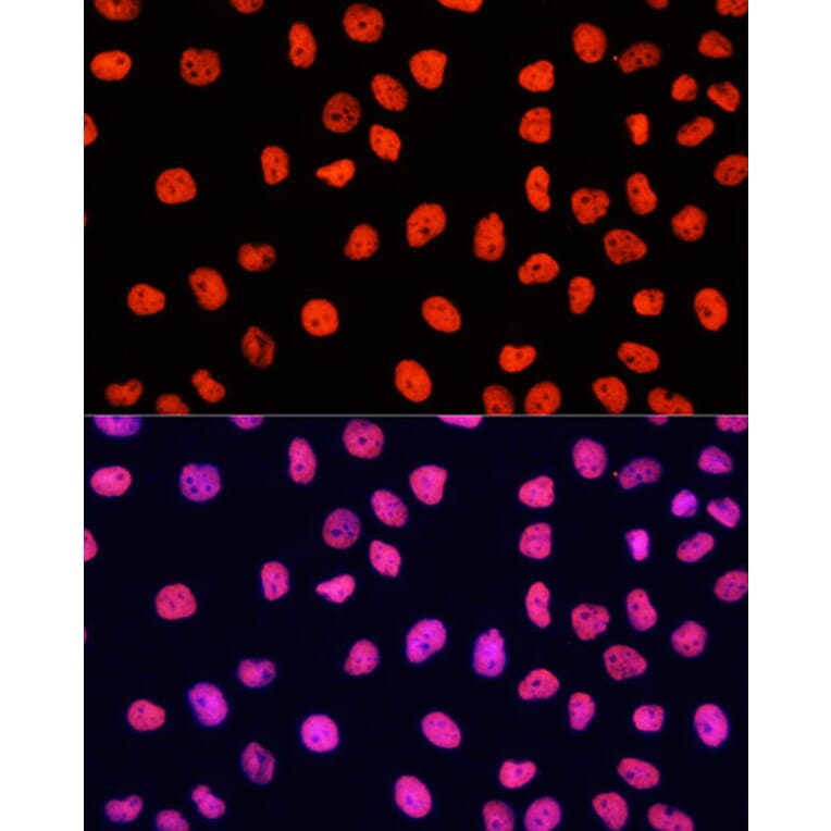 Immunofluorescence - Goat Anti-Rabbit IgG H&L Antibody (Cyanine 3) (A17341) - Antibodies.com