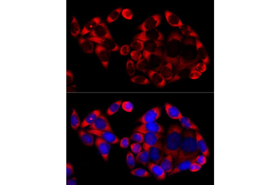 Immunofluorescence - Goat Anti-Rabbit IgG H&L Antibody (Cyanine 3) (A17341) - Antibodies.com