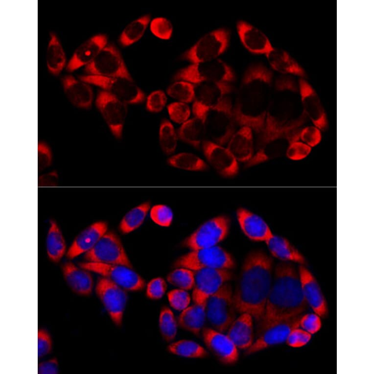 Immunofluorescence - Goat Anti-Rabbit IgG H&L Antibody (Cyanine 3) (A17341) - Antibodies.com