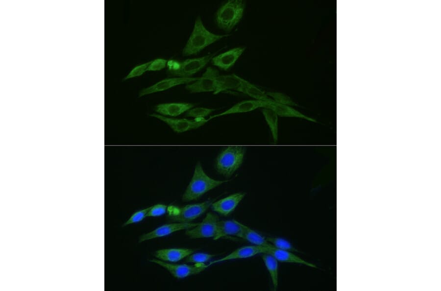 Immunofluorescence - Donkey Anti-Rabbit IgG H&L Antibody (FITC) (A17343) - Antibodies.com