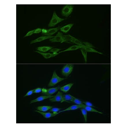 Immunofluorescence - Donkey Anti-Rabbit IgG H&L Antibody (FITC) (A17343) - Antibodies.com