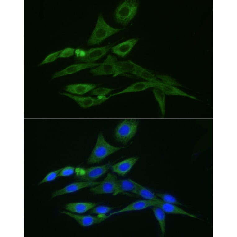 Immunofluorescence - Donkey Anti-Rabbit IgG H&L Antibody (FITC) (A17343) - Antibodies.com