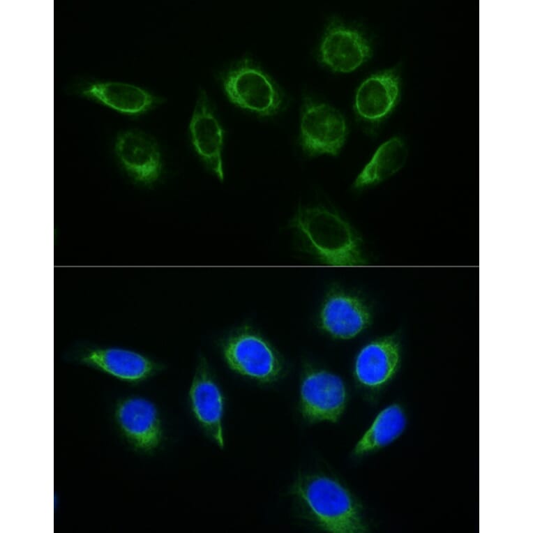 Immunofluorescence - Donkey Anti-Rabbit IgG H&L Antibody (FITC) (A17343) - Antibodies.com