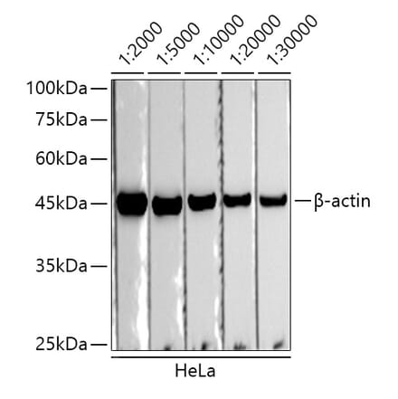 Western Blot - Donkey Anti-Rabbit IgG H&L Antibody (HRP) (A17344) - Antibodies.com