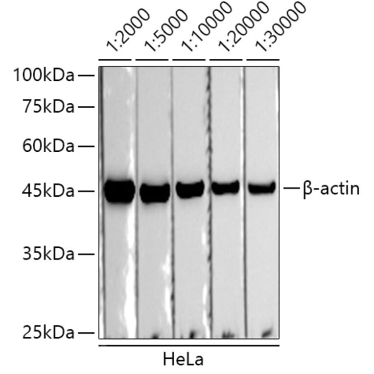 Western Blot - Donkey Anti-Rabbit IgG H&L Antibody (HRP) (A17344) - Antibodies.com