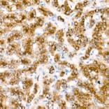 Immunohistochemistry - Donkey Anti-Rabbit IgG H&L Antibody (HRP) (A17344) - Antibodies.com