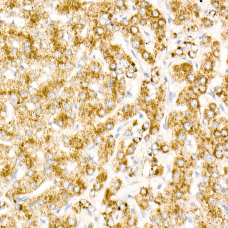 Immunohistochemistry - Donkey Anti-Rabbit IgG H&L Antibody (HRP) (A17344) - Antibodies.com