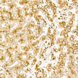 Immunohistochemistry - Donkey Anti-Rabbit IgG H&L Antibody (HRP) (A17344) - Antibodies.com