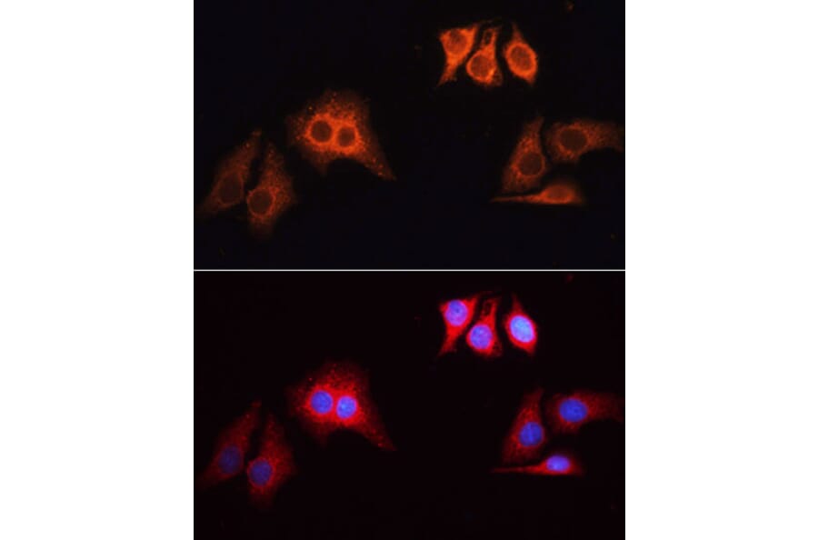 Immunofluorescence - Goat Anti-Rabbit IgG H&L Antibody (TRITC) (A17346) - Antibodies.com