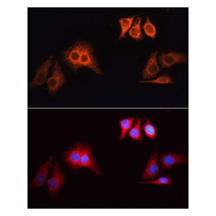 Immunofluorescence - Goat Anti-Rabbit IgG H&L Antibody (TRITC) (A17346) - Antibodies.com