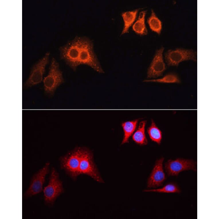 Immunofluorescence - Goat Anti-Rabbit IgG H&L Antibody (TRITC) (A17346) - Antibodies.com