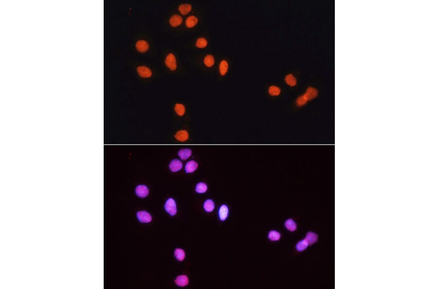 Immunofluorescence - Goat Anti-Rabbit IgG H&L Antibody (TRITC) (A17346) - Antibodies.com