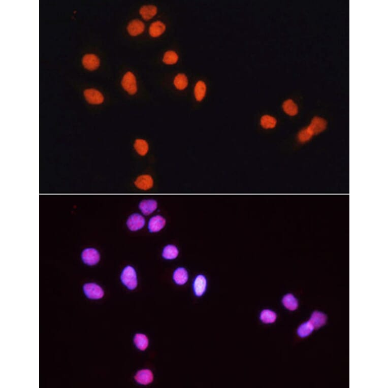 Immunofluorescence - Goat Anti-Rabbit IgG H&L Antibody (TRITC) (A17346) - Antibodies.com