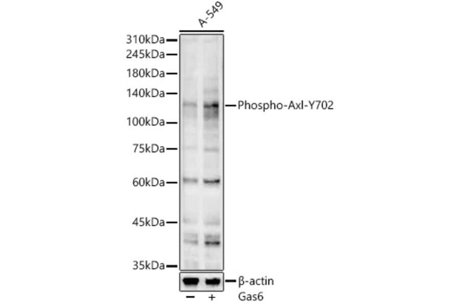 Western Blot - Goat Anti-Mouse IgG H&L Antibody (AP) (A17348) - Antibodies.com