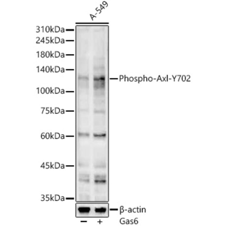 Western Blot - Goat Anti-Mouse IgG H&L Antibody (AP) (A17348) - Antibodies.com