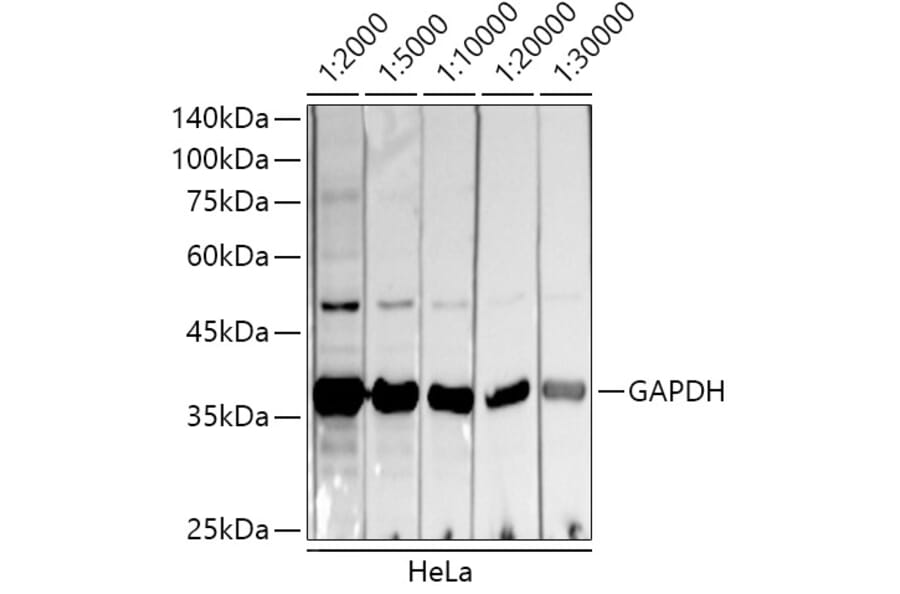Western Blot - Donkey Anti-Mouse IgG H&L Antibody (HRP) (A17351) - Antibodies.com