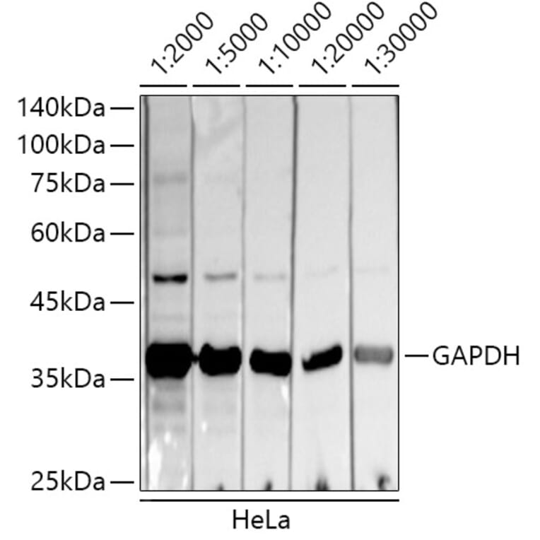 Western Blot - Donkey Anti-Mouse IgG H&L Antibody (HRP) (A17351) - Antibodies.com