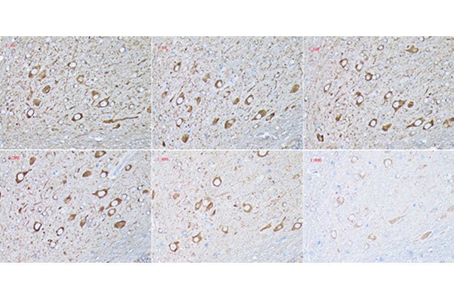 Immunohistochemistry - Donkey Anti-Mouse IgG H&L Antibody (HRP) (A17351) - Antibodies.com