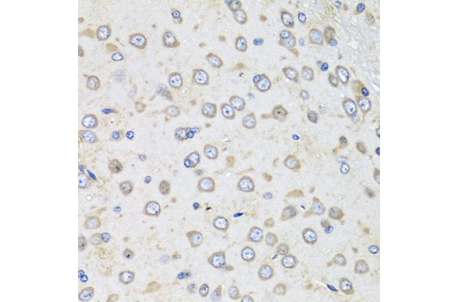 Immunohistochemistry - Donkey Anti-Goat IgG H&L Antibody (HRP) (A17357) - Antibodies.com