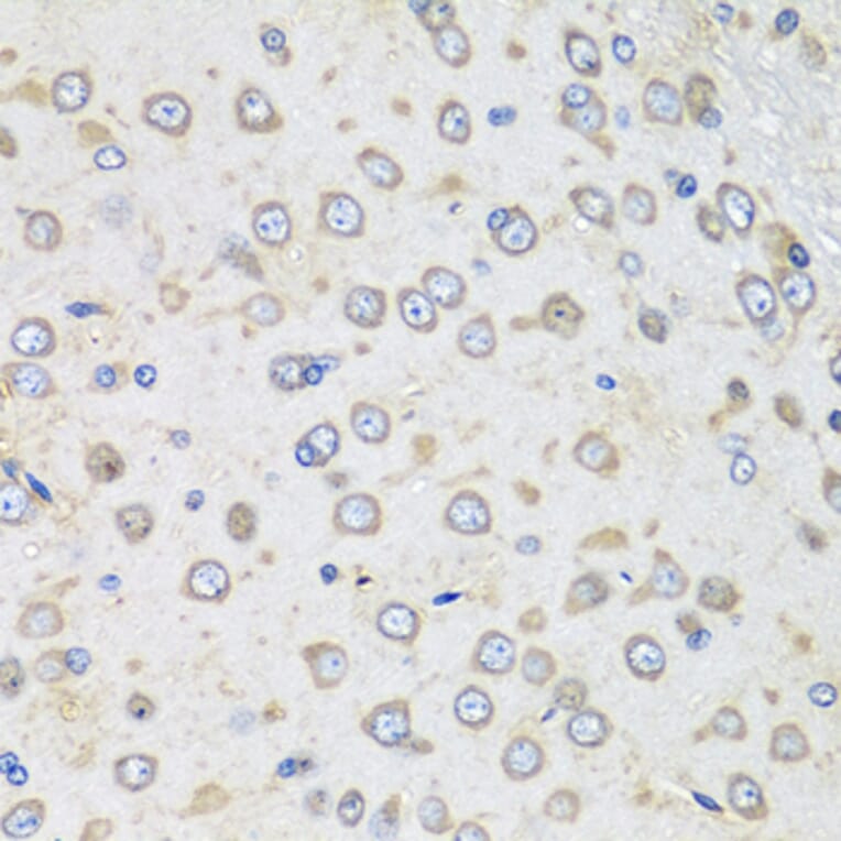 Immunohistochemistry - Donkey Anti-Goat IgG H&L Antibody (HRP) (A17357) - Antibodies.com