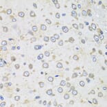 Immunohistochemistry - Donkey Anti-Goat IgG H&L Antibody (HRP) (A17357) - Antibodies.com