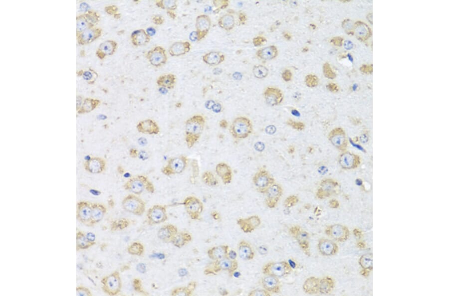 Immunohistochemistry - Donkey Anti-Goat IgG H&L Antibody (HRP) (A17357) - Antibodies.com