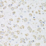Immunohistochemistry - Donkey Anti-Goat IgG H&L Antibody (HRP) (A17357) - Antibodies.com