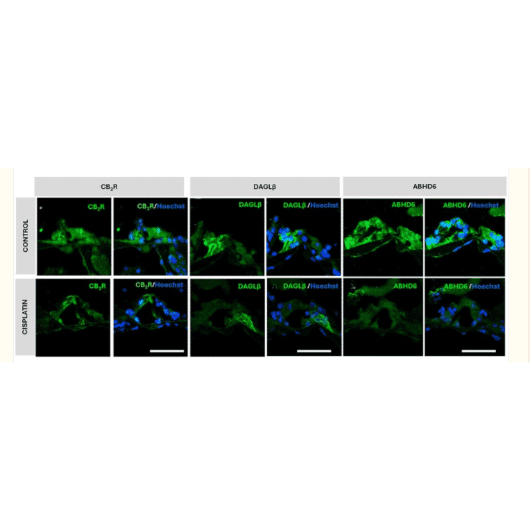Immunohistochemistry - Rabbit Anti-Goat IgG H&L Antibody (HRP) (A17358) - Antibodies.com