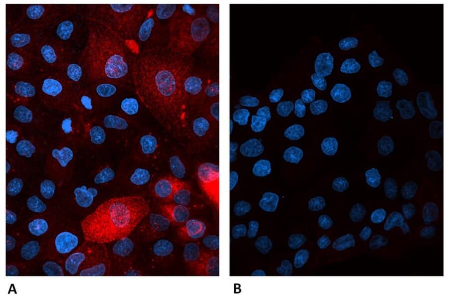 Immunoflouroscence - Anti-beta 2 Microglobulin Antibody [B2M-01] (Alexa Fluor® 647) (A121710) - Antibodies.com