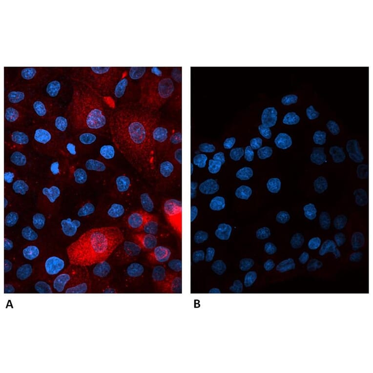 Immunoflouroscence - Anti-beta 2 Microglobulin Antibody [B2M-01] (Alexa Fluor® 647) (A121710) - Antibodies.com