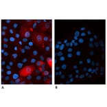 Immunoflouroscence - Anti-beta 2 Microglobulin Antibody [B2M-01] (Alexa Fluor® 647) (A121710) - Antibodies.com