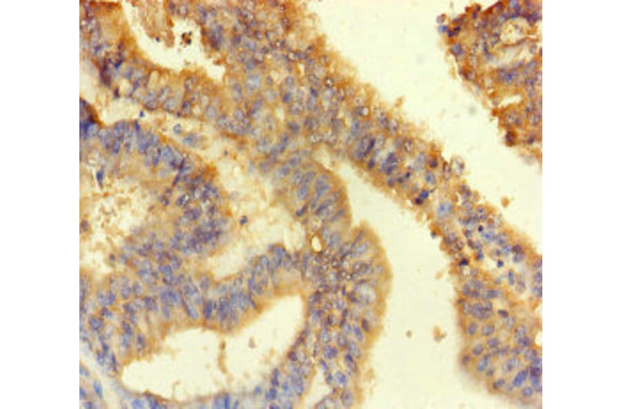 Validation Data - Anti-ANKS6 Antibody (A200109)