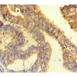 Validation Data - Anti-ANKS6 Antibody (A200109)