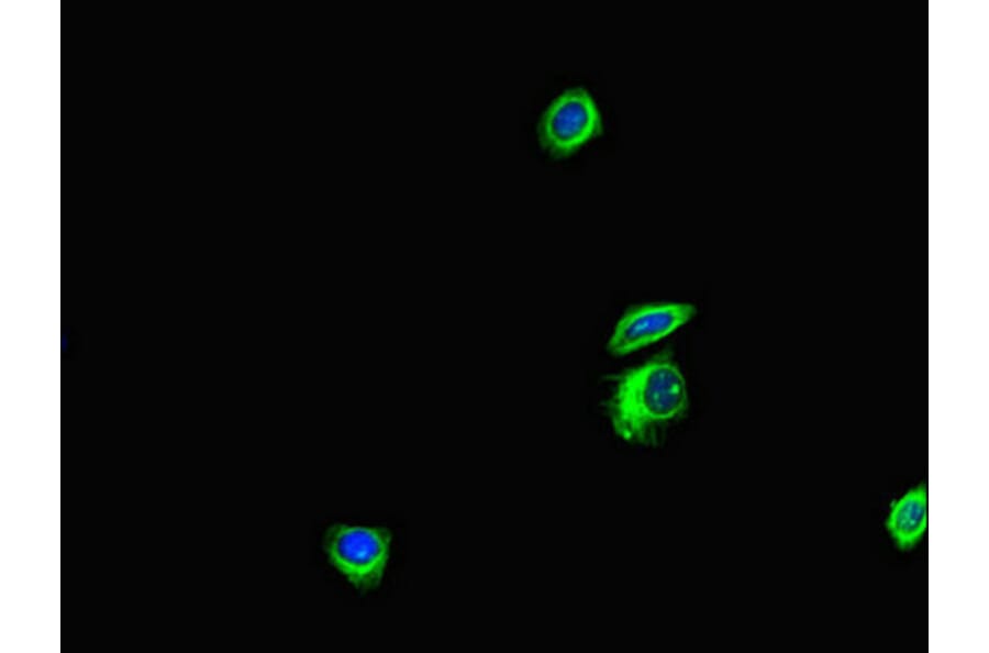 Validation Data - Anti-ANKS6 Antibody (A200109)