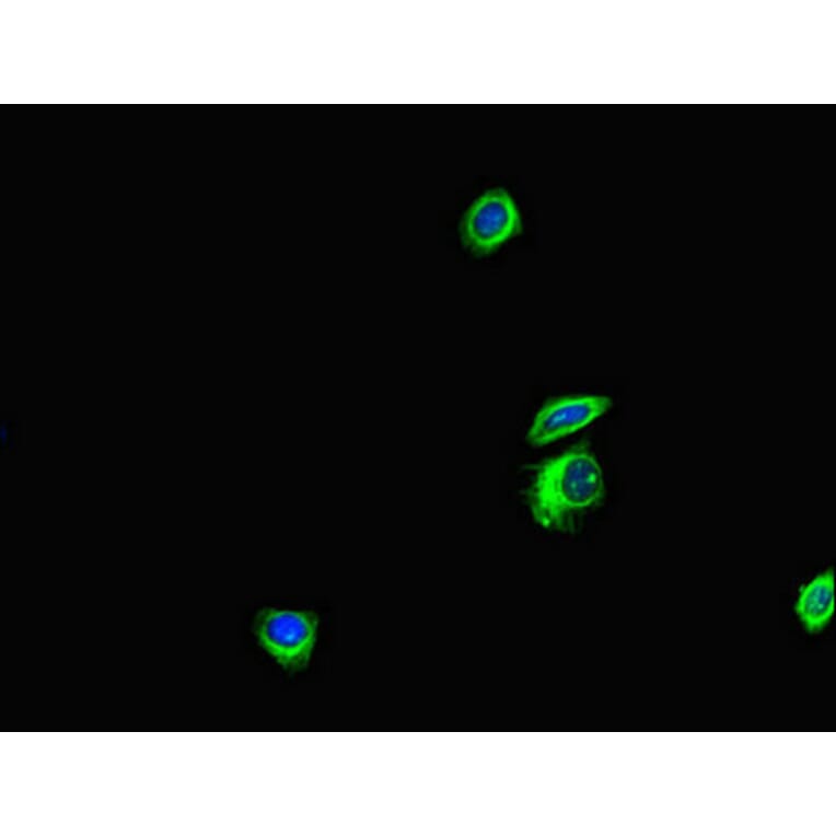 Validation Data - Anti-ANKS6 Antibody (A200109)