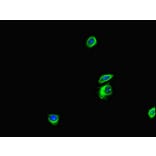 Validation Data - Anti-ANKS6 Antibody (A200109)