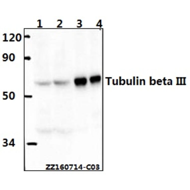 Anti-Tubulin beta III Antibody from Bioworld Technology (AP0013) - Antibodies.com