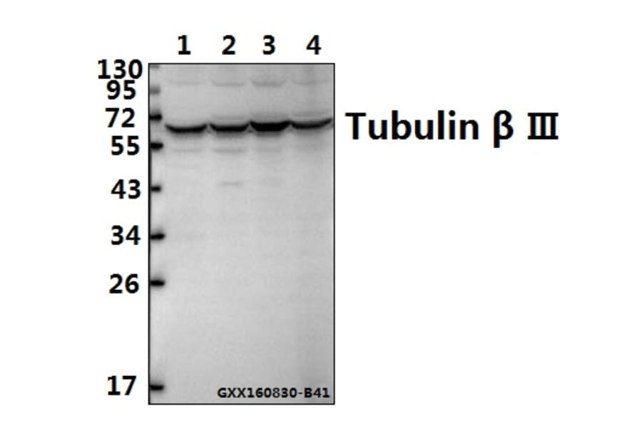 Anti-Tubulin beta III Antibody from Bioworld Technology (AP0013) - Antibodies.com