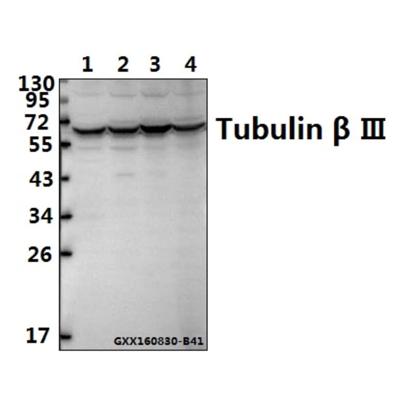 Anti-Tubulin beta III Antibody from Bioworld Technology (AP0013) - Antibodies.com