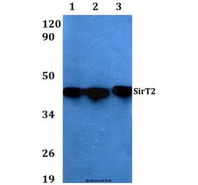 Anti-SIRT2 Antibody from Bioworld Technology (AP0019) - Antibodies.com