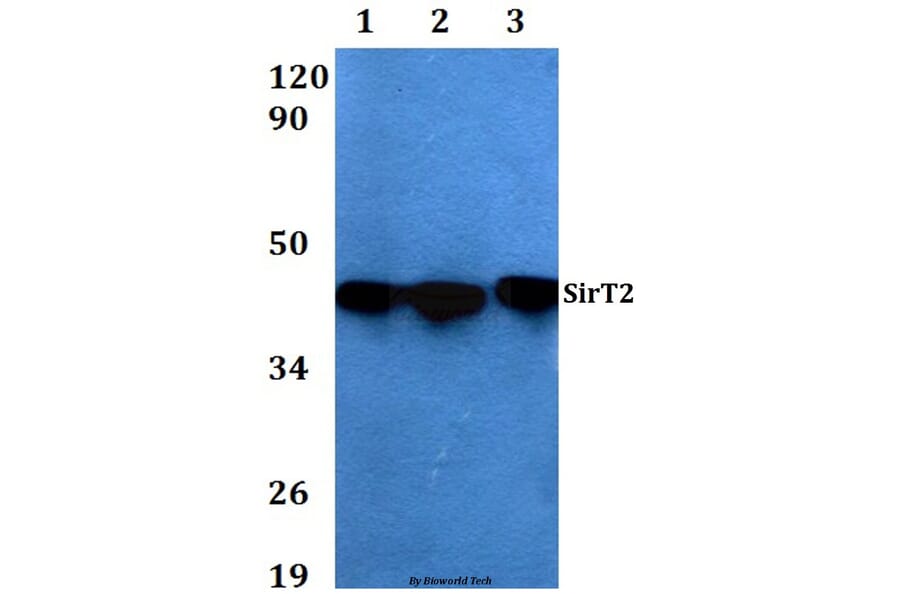 Anti-SIRT2 Antibody from Bioworld Technology (AP0019) - Antibodies.com