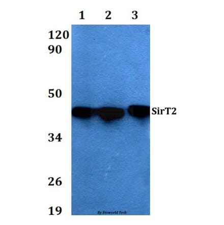 Anti-SIRT2 Antibody from Bioworld Technology (AP0019) - Antibodies.com