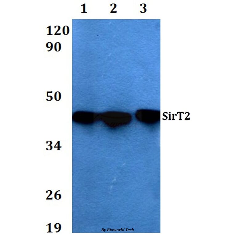 Anti-SIRT2 Antibody from Bioworld Technology (AP0019) - Antibodies.com