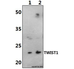 Anti-TWIST1 (M1) Antibody from Bioworld Technology (AP0020) - Antibodies.com