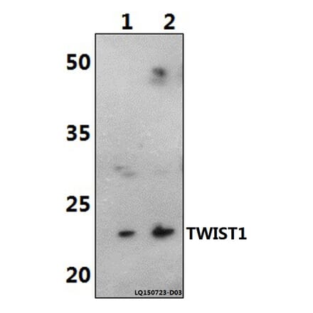 Anti-TWIST1 (M1) Antibody from Bioworld Technology (AP0020) - Antibodies.com