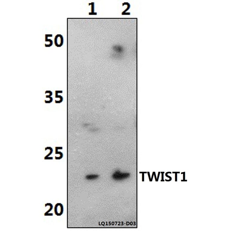 Anti-TWIST1 (M1) Antibody from Bioworld Technology (AP0020) - Antibodies.com